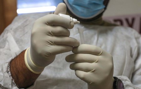 155 са новите случаи на коронавирус, починали са още трима души