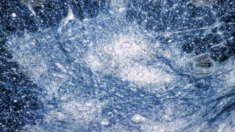 Дива форма на вируса, причиняващ детски паралич, бе открита в отходни води в Германия